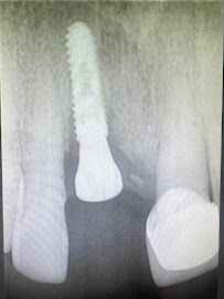 Gio Dental & Med Spa