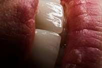 CREO Dental