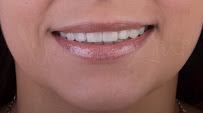 CREO Dental