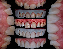 CREO Dental