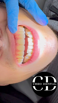CREO Dental