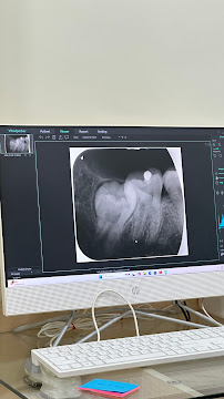 Cdent dental clinic
