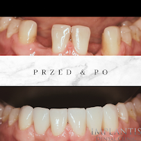 IMPLANTIS 1 Dentysta Kraków