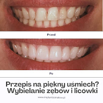 IMPLANTIS 1 Dentysta Kraków