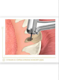 Center for Implantology and Aesthetic Dentistry CICHOŃ