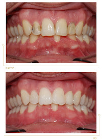 Center for Implantology and Aesthetic Dentistry CICHOŃ