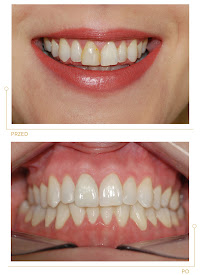 Center for Implantology and Aesthetic Dentistry CICHOŃ