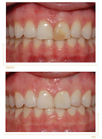 Center for Implantology and Aesthetic Dentistry CICHOŃ