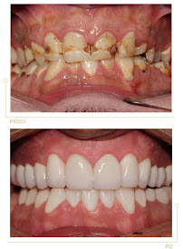Center for Implantology and Aesthetic Dentistry CICHOŃ