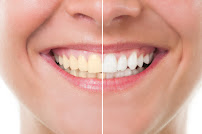 Dental Migas Clinic - Stomatologia i Implantologia