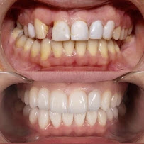 Centrum Stomatologii Dentamax - Dentysta Kraków
