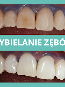 Centrum Stomatologii Dentamax - Dentysta Kraków