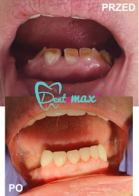 Centrum Stomatologii Dentamax - Dentysta Kraków