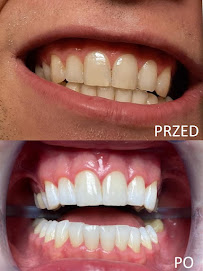 Centrum Stomatologii Dentamax - Dentysta Kraków
