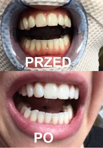 Centrum Stomatologii Dentamax - Dentysta Kraków