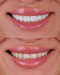 Cancun Dental Specialists