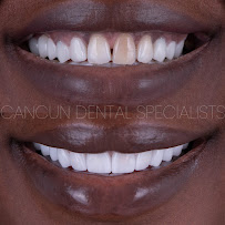Cancun Dental Specialists