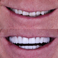 Cancun Dental Specialists