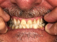 Cancun Dental Specialists