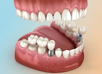 Centrum Stomatologii Dental Esthetic Monika i Piotr SOKÓŁ Kraków