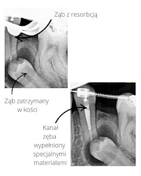 Holistic Dent - Centrum Stomatologiczne Kraków