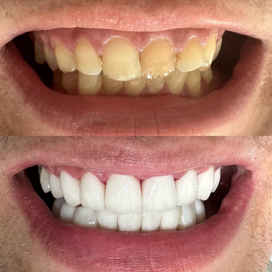 Klinika stomatologii, metamorfoz uśmiechów i BONDINGU myDentist - dental clinic in Krakow