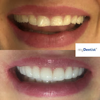 Klinika stomatologii, metamorfoz uśmiechów i BONDINGU myDentist