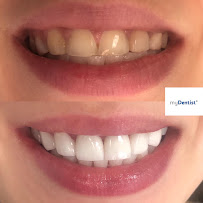 Klinika stomatologii, metamorfoz uśmiechów i BONDINGU myDentist