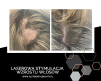 Alfa Dental & Beauty Medycyna Estetyczna, Stomatologia, Laseroterapia Kraków
