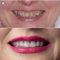 OptimDent - Dentist Warsaw