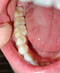 MP-Dental