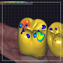 Mistodent Dentistry Warsaw