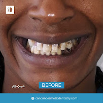 Cancun Cosmetic Dentistry