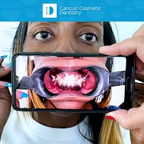 Cancun Cosmetic Dentistry