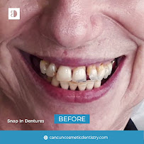 Cancun Cosmetic Dentistry