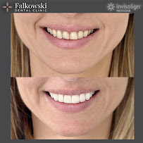 Falkowski Dental Clinic Warszawa Ortodoncja - Invisalign