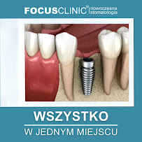 Focus Clinic Warszawa