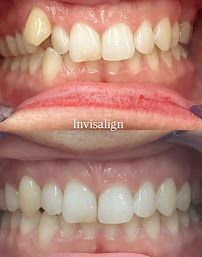 Queen Dental Clinic