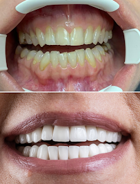 Belgrade Dental Tour - (Dental Tourism, Dental clinic in Belgrade Serbia)