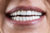 Belgrade Dental Tour - (Dental Tourism, Dental clinic in Belgrade Serbia)