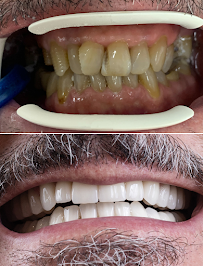 Belgrade Dental Tour - (Dental Tourism, Dental clinic in Belgrade Serbia)