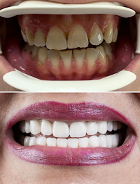 Belgrade Dental Tour Dental Clinic in Belgrade, Serbia