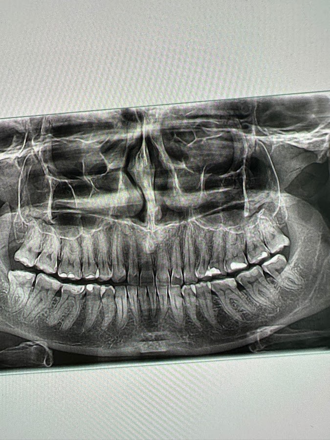 Pro Dental Centar - dental clinic in Belgrade, Serbia