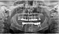 Pro Dental Centar