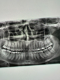 Pro Dental Centar
