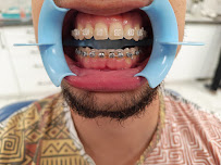 Pro Dental Centar