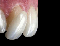 Dentalux