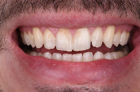 Dentalux
