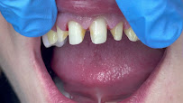 Marco Dental Tourism - Dentist Belgrade Serbia