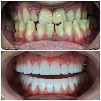 Marco Dental Tourism - Dentist Belgrade Serbia